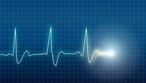electrocardiograph