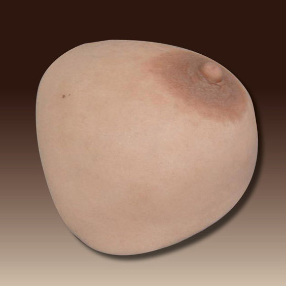 Breast Cosmetic Prosthesis Schubert And Braun Prothesenwerk Adult