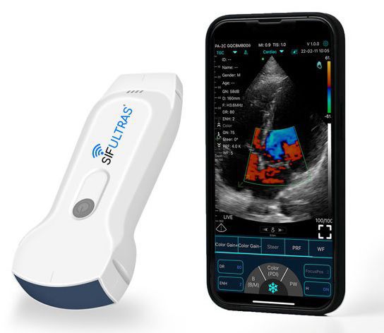 Hand Held Ultrasound System Sifultras Sifsof For