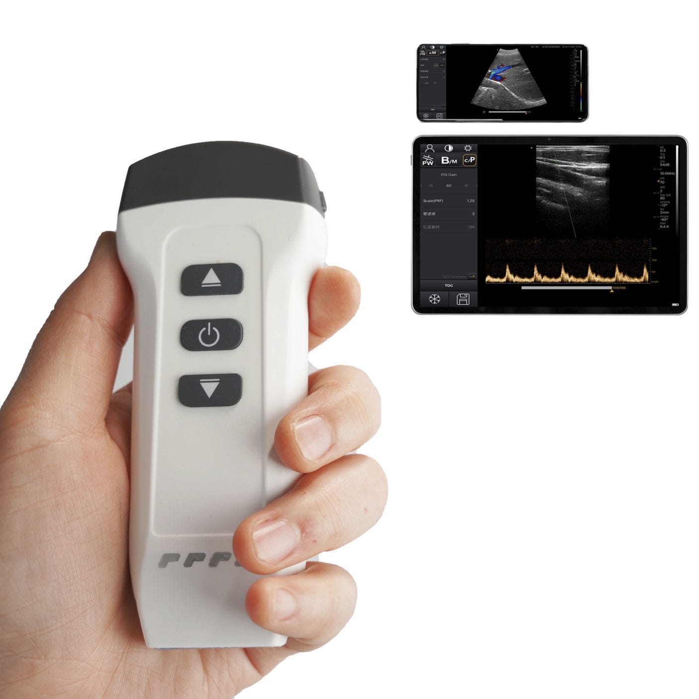 Hand Held Ultrasound System DW X1 Dawei Medical For Gynecological