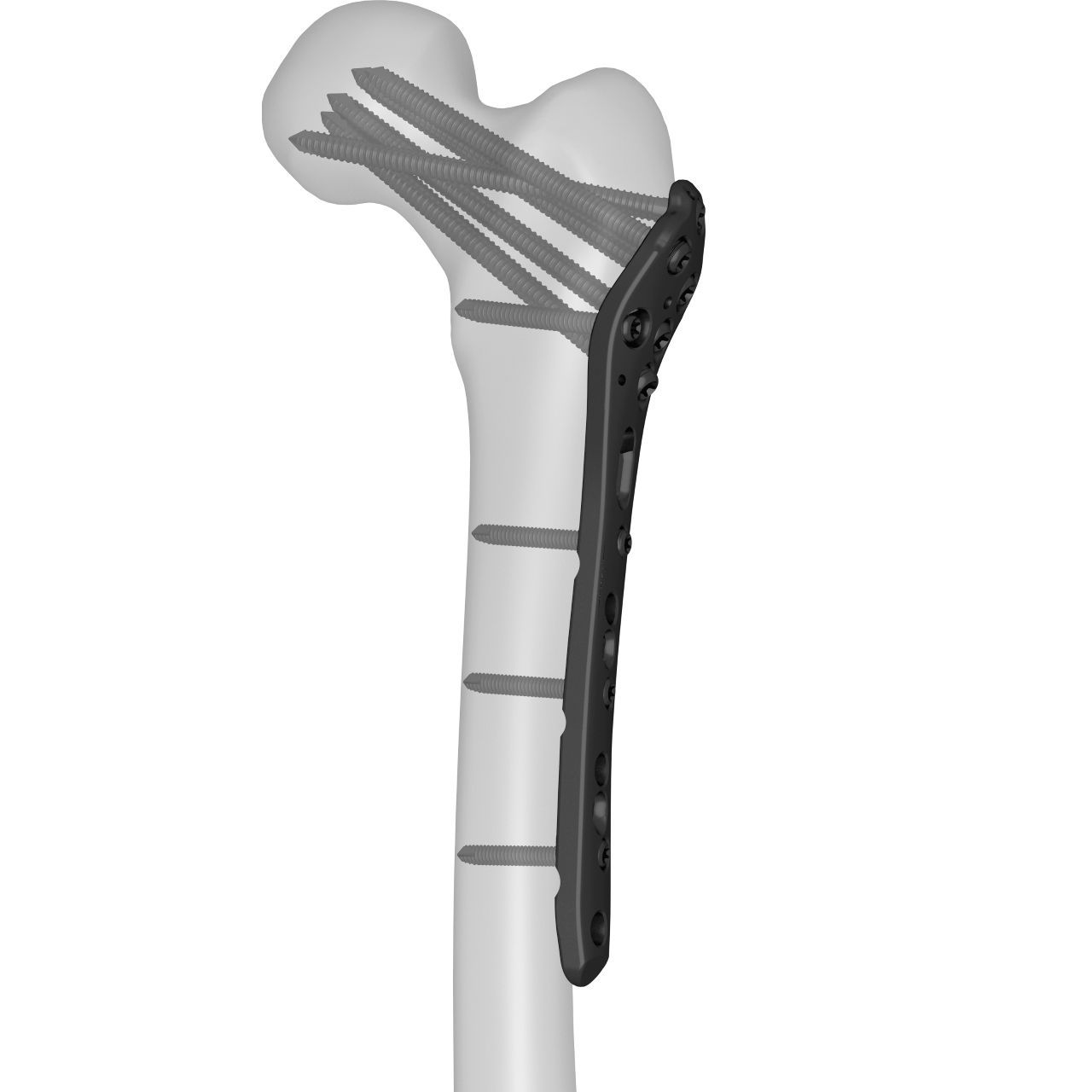 Femoral Compression Plate Series Boneunion Medical