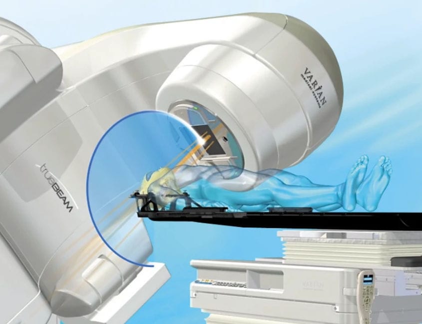 Stereotactic Radiosurgery Linear Particle Accelerator HyperArc