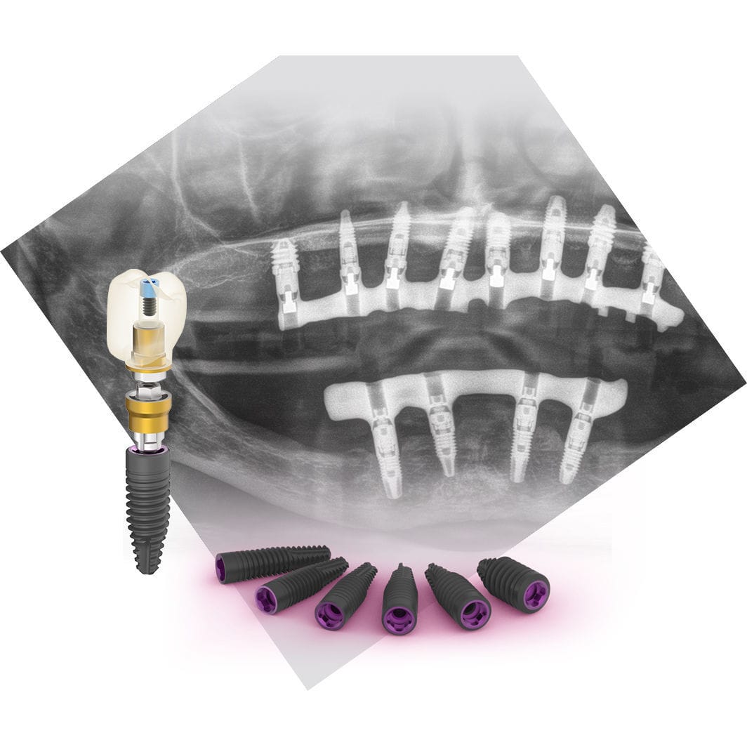 Cylindrical Dental Implant Core Bti Biotechnology Institute