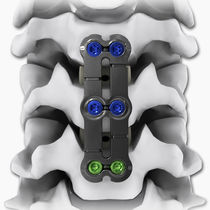 Life Spine Secondary Care Medicalexpo