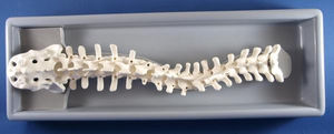 vertebral column model / scoliosis