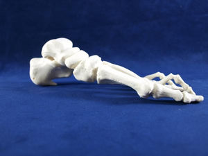 foot model / bone / for teaching / pathological