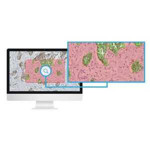image analysis software module / measurement / for histopathology laboratories / immunohistochemistry