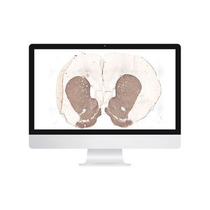 image analysis software module / anatomy / for neuroimaging