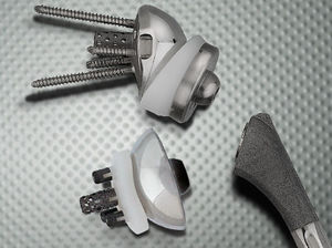 reverse shoulder prosthesis / revision