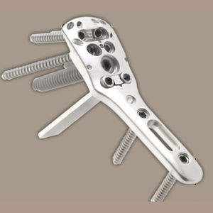 humerus compression plate / proximal