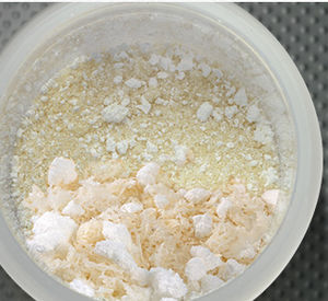 allograft bone substitute / orthopedic surgery / malleable
