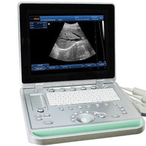 portable ultrasound system / for multipurpose ultrasound imaging / B/W / built-in console