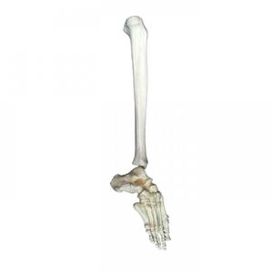 foot model / tibia / for teaching / pathological