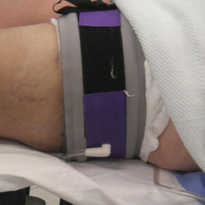 operating table leg holder