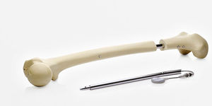 femur intramedullary nail / tibia / proximal / distal