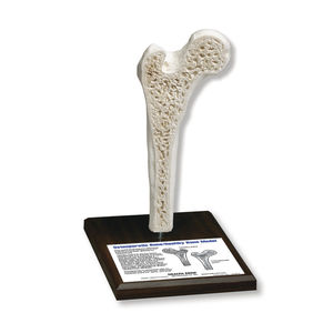 bone model / osteoporosis