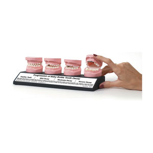 denture model / pathological / dental care / child