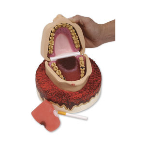 denture model / gingival / pathology