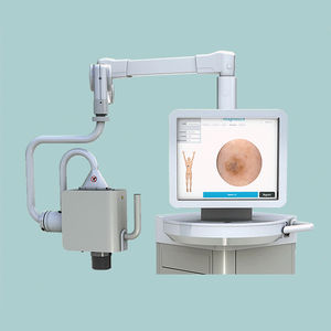skin pigmentation skin analysis system