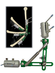 elbow external fixation system / tubular / adult