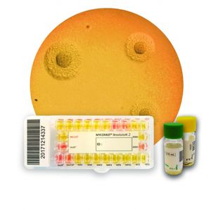 antibiotic susceptibility testing test kit / Mycoplasma / Ureaplasma urealyticum / urogenital
