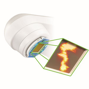 radiation therapy QA system / monitoring