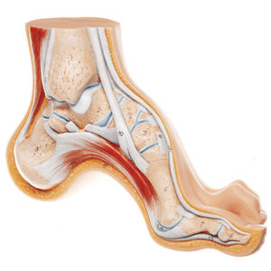 foot model / pathological