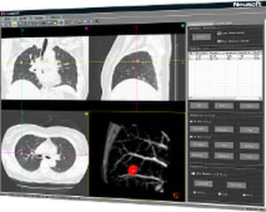 visualization software / analysis / CT