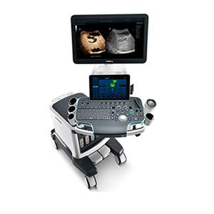 on-platform ultrasound system / for multipurpose ultrasound imaging / for gynecological and obstetric ultrasound imaging / 3D/4D