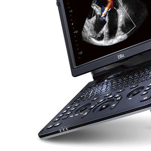 portable ultrasound system / for cardiovascular ultrasound imaging / color doppler / built-in console