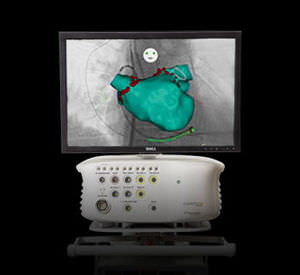 cardiac mapping system / electromagnetic