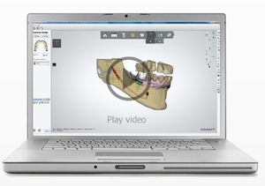 dental prosthesis design software / planning / for dental implantology