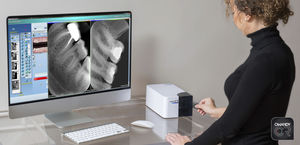 intraoral phosphor screen scanner