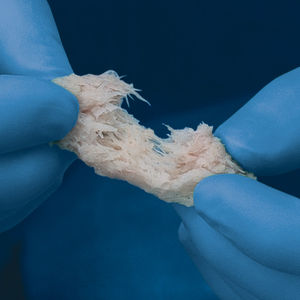 allograft bone substitute / orthopedic surgery / malleable