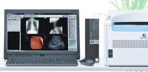 radiography acquisition system / portable