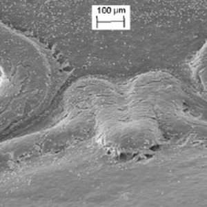 coronary stent / cobalt-chromium