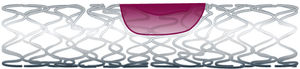 coronary stent / cobalt-chromium