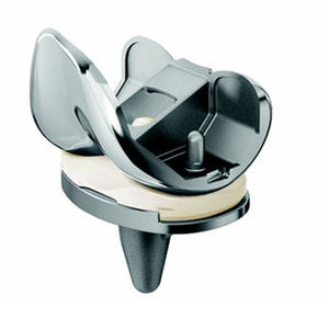 three-compartment knee prosthesis / fixed-bearing