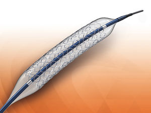 peripheral stent / stainless steel / self-expanding