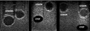 MRI test phantom / for CT scan / for ultrasound imaging / breast