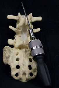 manual orthopedic screwdriver