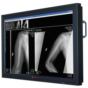 surgical display / radiology / high-definition / LCD