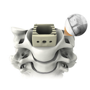 Cervical Interbody Fusion Cage Plateau C Ti Life Spine Anterior