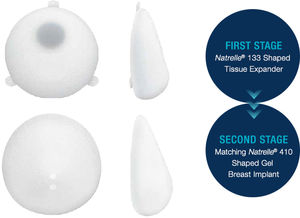 breast tissue expander / breast-shaped