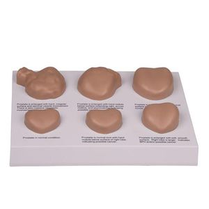 prostate model / pathology / prostate examination