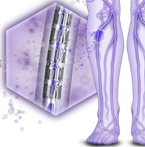 peripheral stent / drug eluting