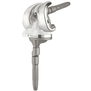 three-compartment knee prosthesis / revision