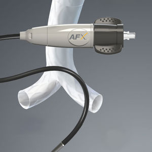 abdominal aorta stent graft / ePTFE