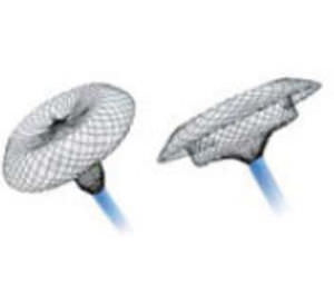 atrial septal defect occlusion device