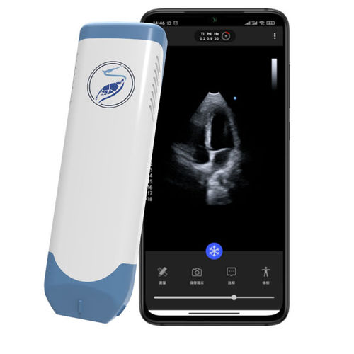 Hand Held Ultrasound System Lite P Beijing Itrason Technologies